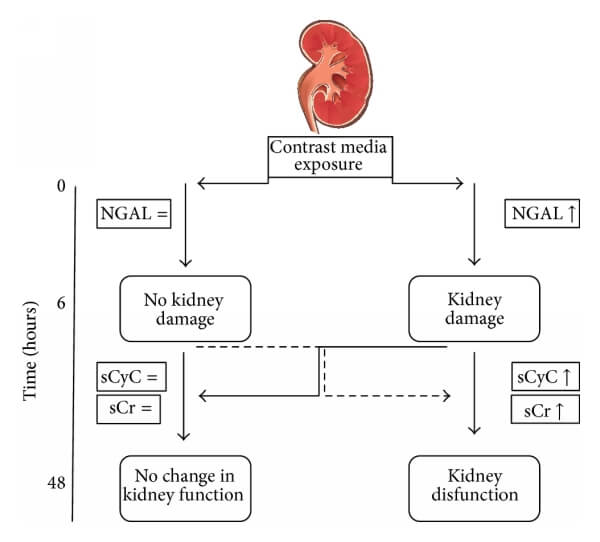 胱抑素C（CysC）與NGAL、肌酐的關系